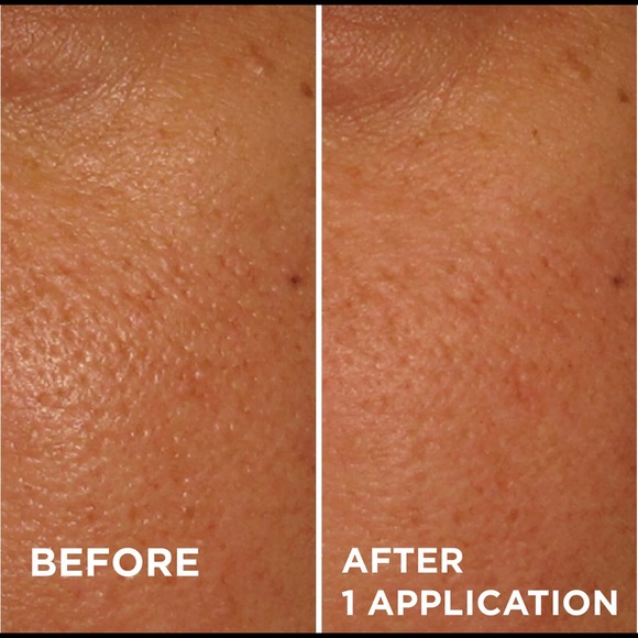 **2/$50 Dr.Brant PoreDermabrasion - Picture 3 of 3